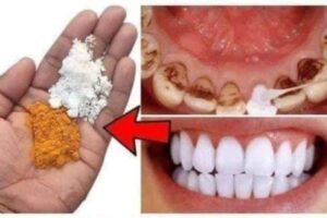 Como Clarear Seus Dentes em apenas 2 minutos