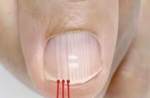 Um Sinal de Alerta Para a Sua Saúde?