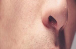 Se Essa Marca Aparecer na Boca, Isto É o Que Seu Corpo Está Tentando Avisar