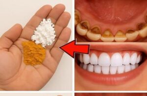 Como Clarear Seus Dentes em Apenas 2 Minutos com Ingredientes Que Você Tem em Casa