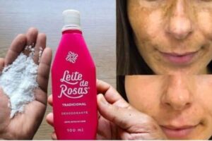 É dessa forma que você remove mancha e peles com 1 ingrediente que você tem em