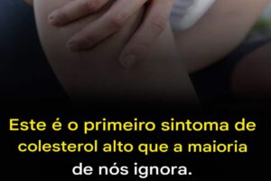 Esse é o primeiro sintoma de colesterol alto que muita gente ignora