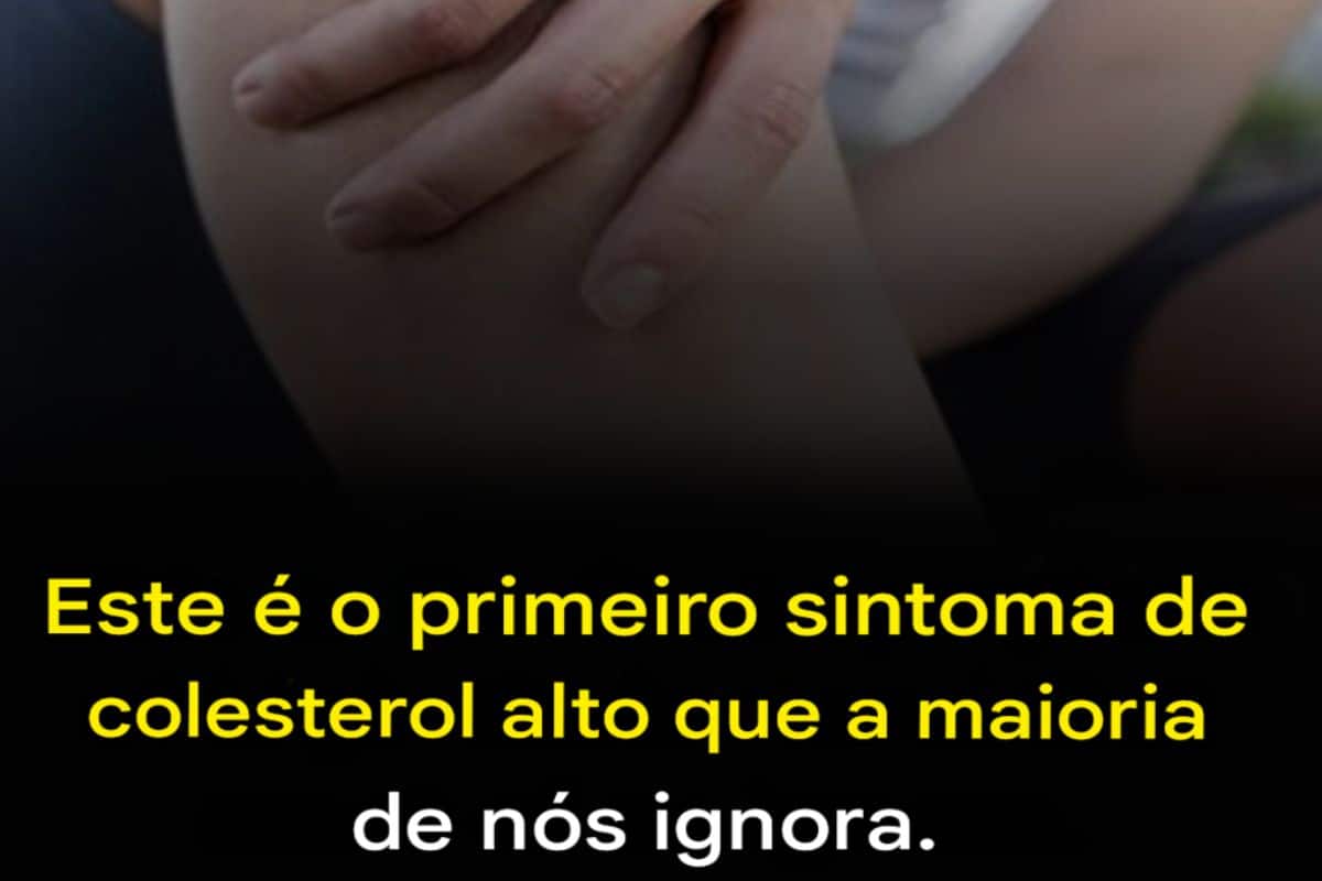 Esse e o primeiro sintoma de colesterol alto que muita gente ignora