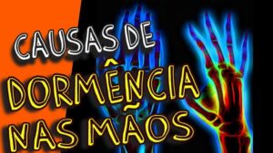 10 CAUSAS DE DORMÊNCIAS NAS MÃOS E DEDOS: Tem FORMIGAMENTO e DOR nas mãos e dedos? CUIDADO!