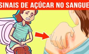7 Sinais de que o açúcar está alto no sangue e como prevenir o diabetes