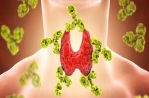 10 Sintomas do Hipotireoidismo: Identifique os Sinais