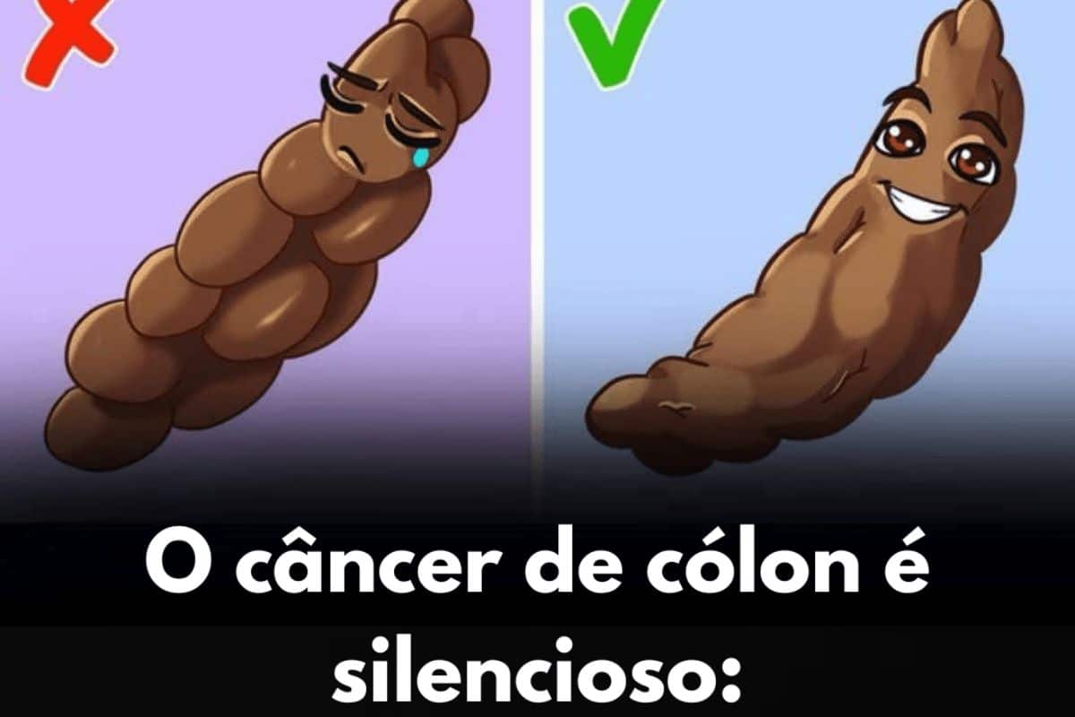 O cancer de colon e silencioso