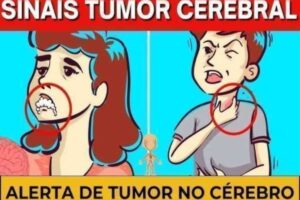10 sinais de alerta de que você tem um possível tumor cerebral