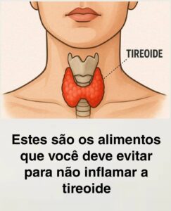 Estes são os alimentos que você deve evitar para não inflamar a tireoide