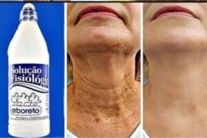 Como acabar com manchas e rugas em poucos dias