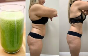 Seque Até 4kg com Suco Detox para Emagrecer: Receita Natural para Auxiliar na Perda de Peso