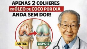 Espere um segundo! Este lendário ortopedista de 97 anos revela o alimento nº 1 que pode ajudar a apoiar a saúde da cartilagem do joelho — e quase ninguém comenta sobre isso!